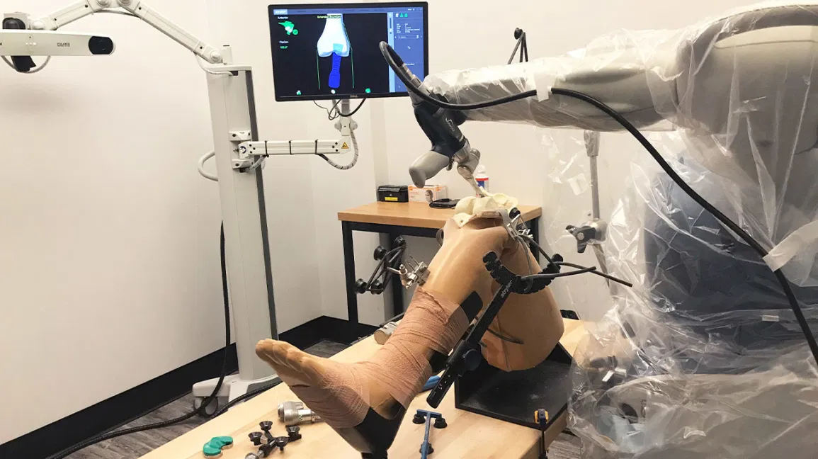 Robotic Knee Replacement blog