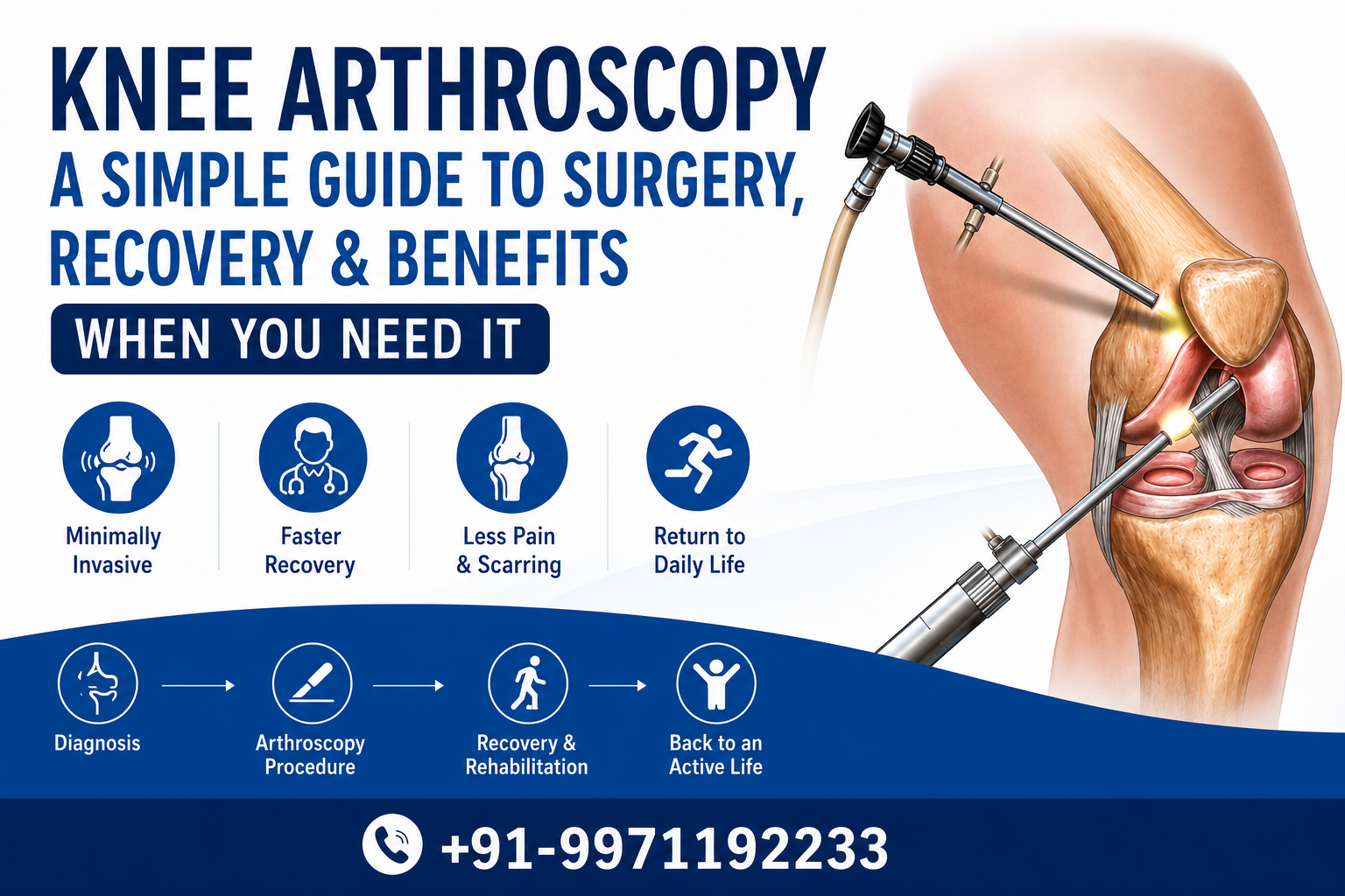 Knee Arthroscopy: A Simple Guide to Surgery, Recovery, Benefits & When You Need It